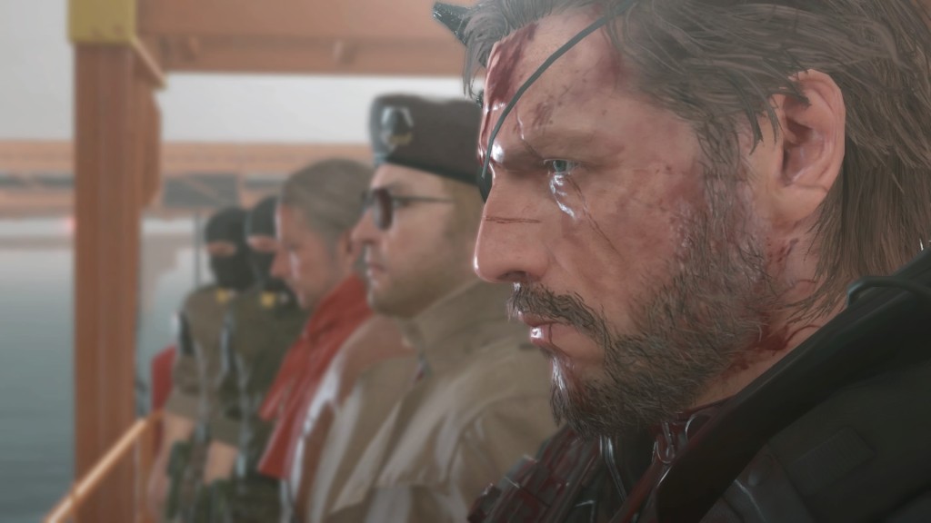MGS V Diamond Dogs